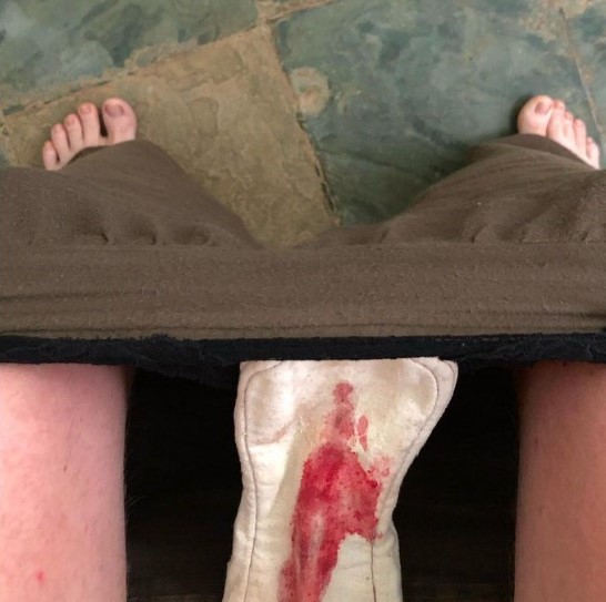 how much you bleed?